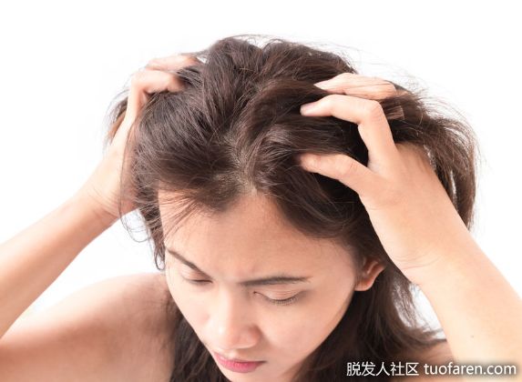 【圖】你是正常掉髮還是異常掉髮?教你簡易分辨方式