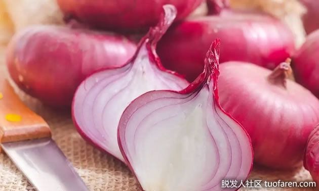 【圖】塗洋葱促生髮、避孕藥治禿頭?小心接觸性皮膚炎