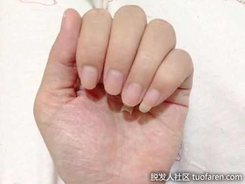 【圖】從指甲與舌頭　判斷孩子的健康狀況(上)