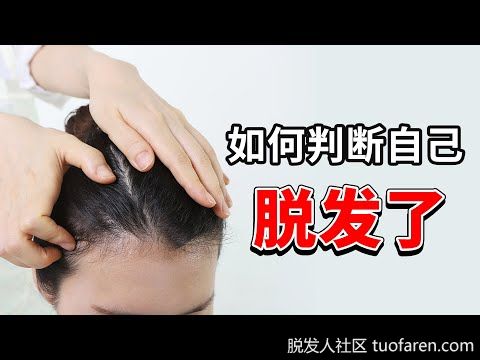 【圖】髮型師教用2隻手指自我檢測「脱髮危機」：超過6條極危險