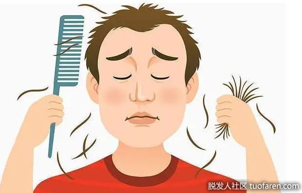 【圖】常見的脱髮可歸納三大類