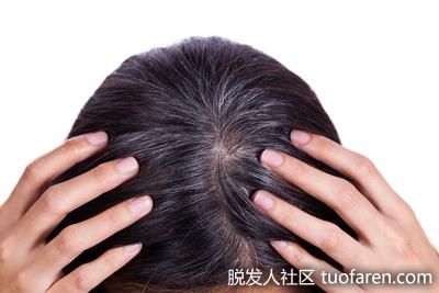 【圖】40歲前白髮或肝腎功能不全! 5招護髮吃黑用梳有秘技