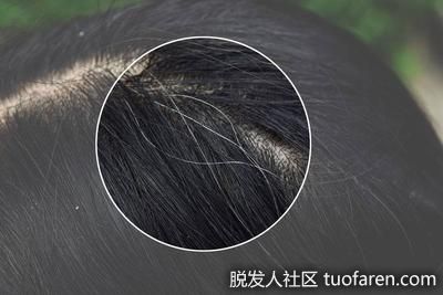 【圖】【白髮成因】頭頂白髮腎氣差、前額白髮飲食不良? 4類黑髮食物豆漿莧菜