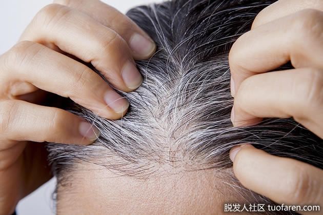 【圖】中醫淺談脱髮白髮 生薑水及梳頭效用