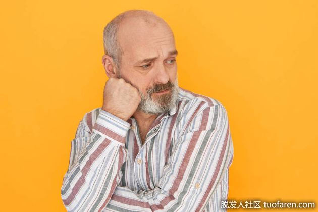 【圖】禿頭有先後天之分！醫：後天性禿頭需找出病因診治