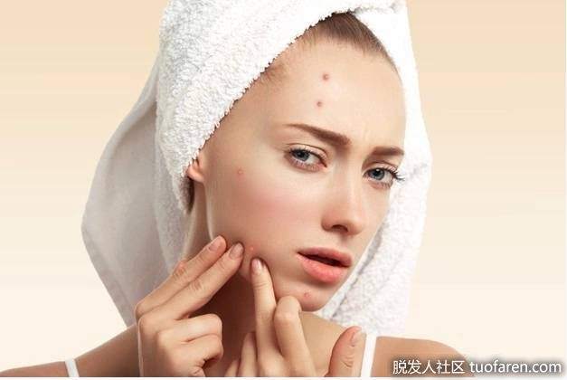 【圖】肝火過旺滿臉痘！穴位按摩搭配菊花養肝茶助改善