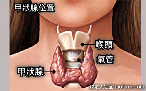 【圖】焦躁腹瀉掉髮 恐是甲亢上身