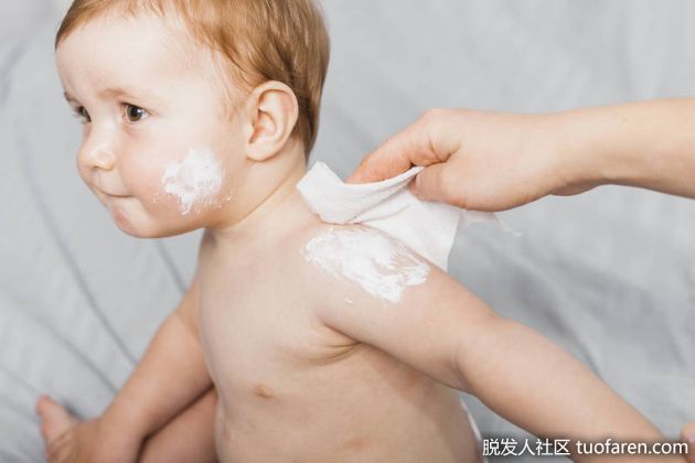 【圖】寶寶臉上出現油痂、紅疹？醫詳解「脂溢性皮炎」判別與照護