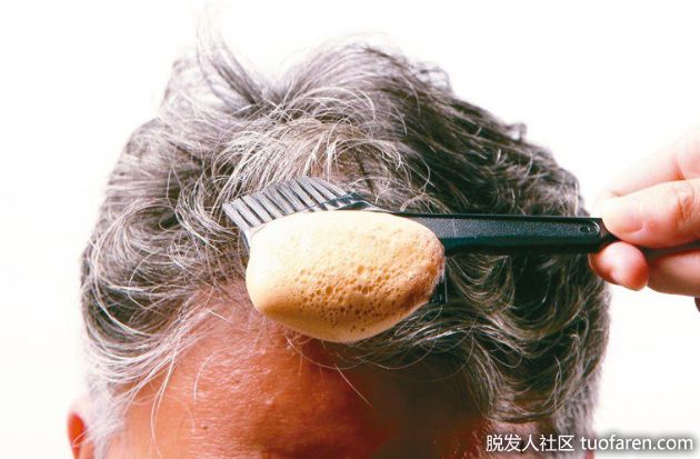 【圖】染髮前要洗頭嗎？醫：兩個動作不能省