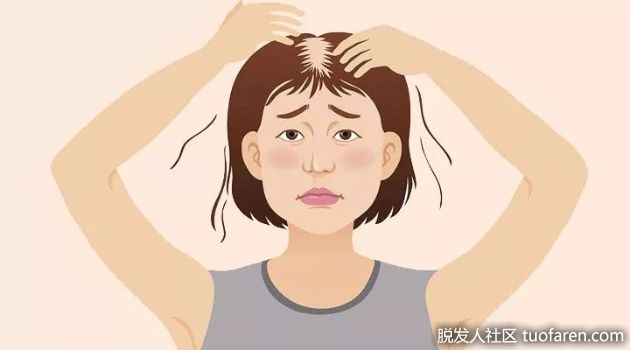 【圖】藥物引起脱髮怎麼辦？專家提醒：引起的原因很多，脱髮後勿自行停藥！