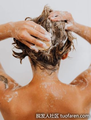 【圖】一直掉髮怎麼辦？ 6招防止髮量變少 洗頭不能天天洗