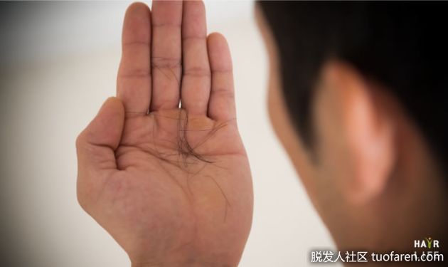 【圖】頭髮掉不停、愈來愈稀疏？你可能是這些營養不夠了