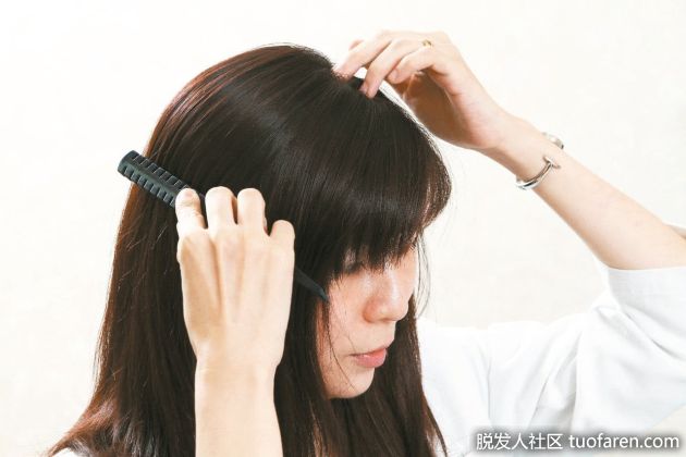 【圖】中年人掉髮原因與預防對策總整理