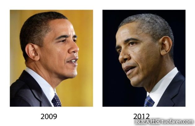 【圖】長出白髮的6大原因 注意！有可能是健康出問題