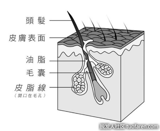 【圖】「Poo-free」不用洗髮水讓脱髮減少、治好頭皮癢？皮膚科醫師這麼説