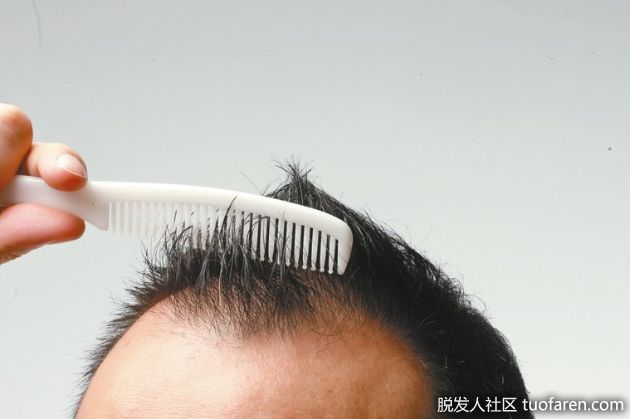 【圖】怕掉髮少洗頭？皮膚科醫師：掉更多