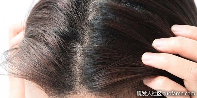 【圖】入冬頭髮飄雪花 頭皮也要去角質？