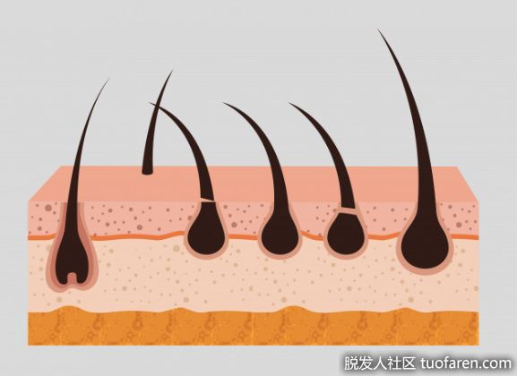 【圖】頭皮適性保養，禿頭夢魘退散!