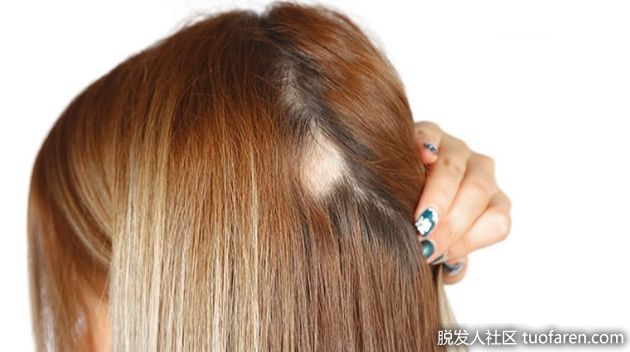 【圖】頭髮越洗越稀疏？專家教你選洗髮產品