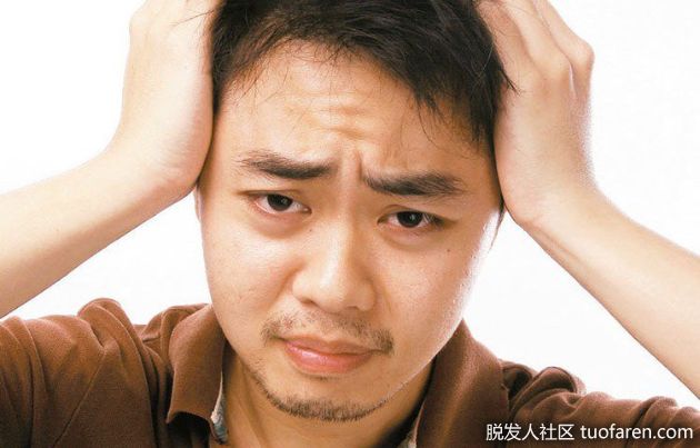 【圖】早發雄性脱髮 易患心血管疾病