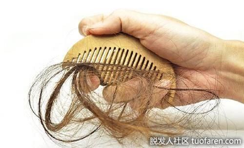 【圖】按摩、洗頭 不能抑制脱髮