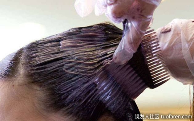 【圖】太常染燙變禿 28歲女有40歲頭皮