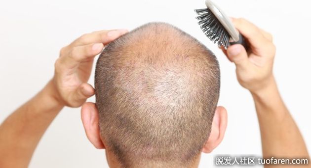 【圖】陽痿、掉髮有救了 補充10大含鋅食物