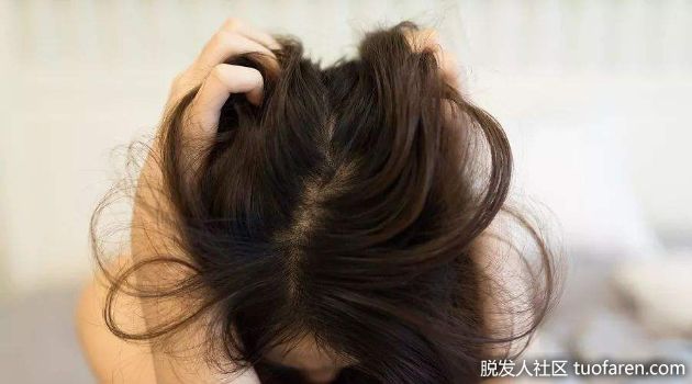 【圖】頭髮油滋滋 當心是內臟出狀況