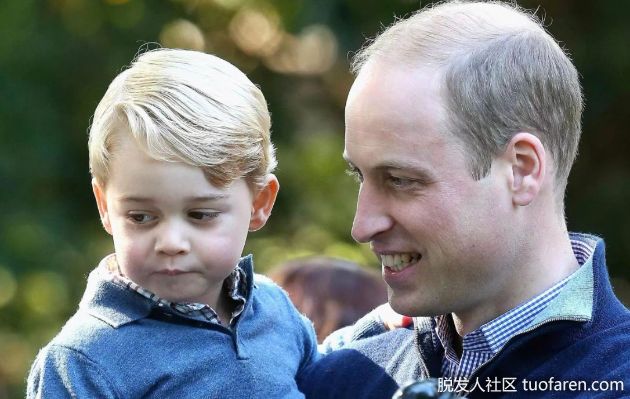 【圖】什麼是大量掉髮或禿頭？