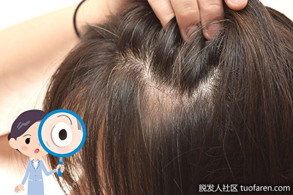 【圖】缺鐵易掉髮?養髮你需要這些礦物質和食物