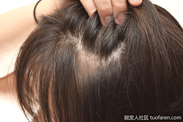 【圖】頭皮屑多又癢？4種抗屑洗髮水 藥師教你挑