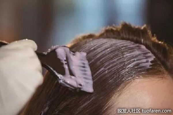 【圖】反覆染髮 頭皮發炎