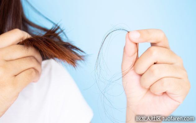 【圖】脱髮怎麼辦?專業醫師這樣説
