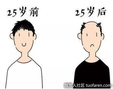 【圖】男孩越來越憂鬱 竟然是因為頭髮越來越少!
