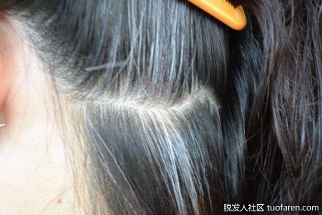 【圖】年紀輕輕就生白髮？送你兩個抗衰老食譜