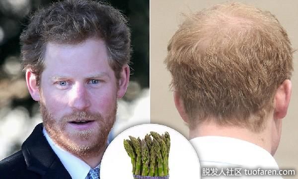 【圖】三千煩惱絲! 哈利王子狂吃蘆筍防掉髮 　