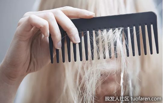 【圖】男人擔心禿頭？破解脱髮9大誤區