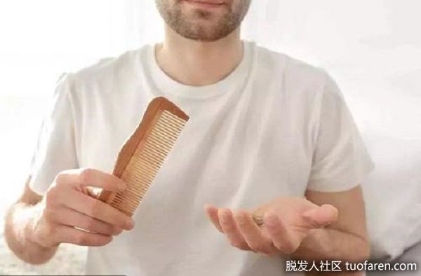 【圖】壓力大 導致青年人雄性脱髮提早出現