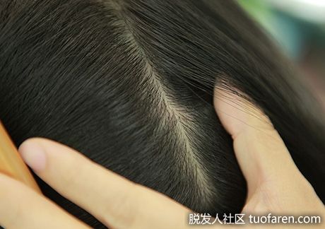 【圖】秋冬護髮 注意頭皮保養最重要