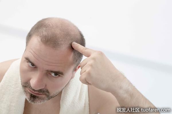 【圖】異常掉髮問與答