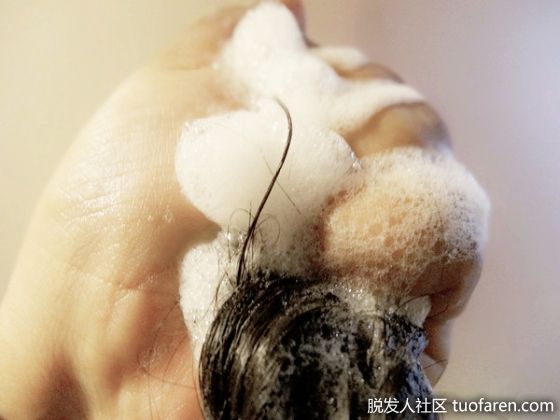 【圖】抗脱髮產品多 先查明原因再買