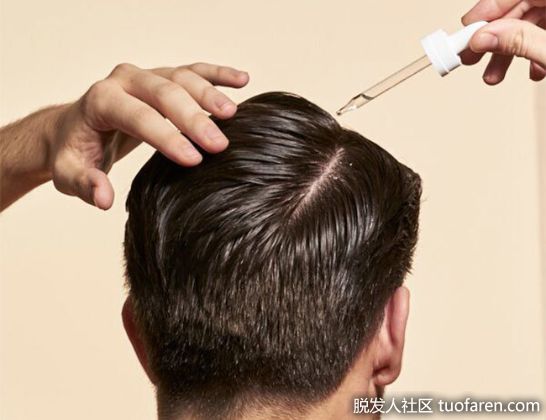 【圖】治脱髮亂用偏方 治不好 更容易禿