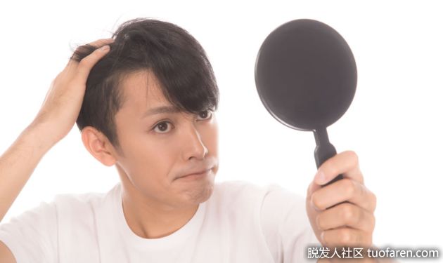 【圖】造成髮際線後退的八大原因!