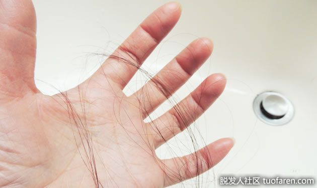 【圖】用了養髮液頭髮反而掉更多?原來是初期掉髮!