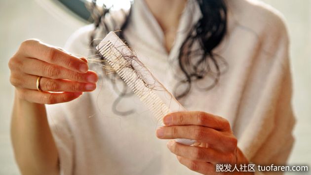 【圖】頭髮掉這麼多正常嗎?教你從掉髮情形判斷脱髮危機
