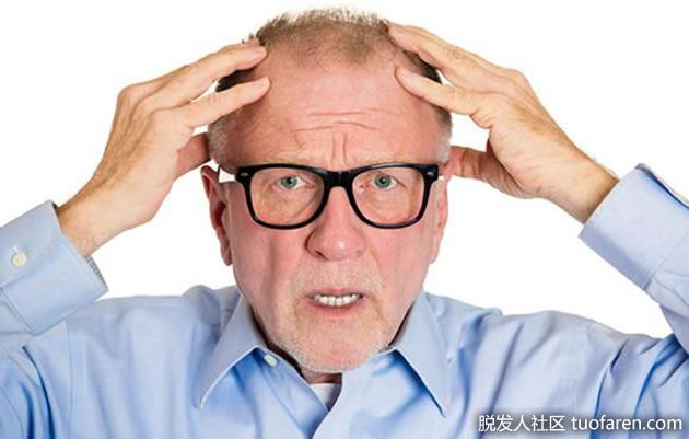【圖】老年人脱髮沒藥醫！ ？掉髮原因及對策一次告訴你！