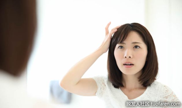 【圖】自體植髮——高額頭女孩的救星！