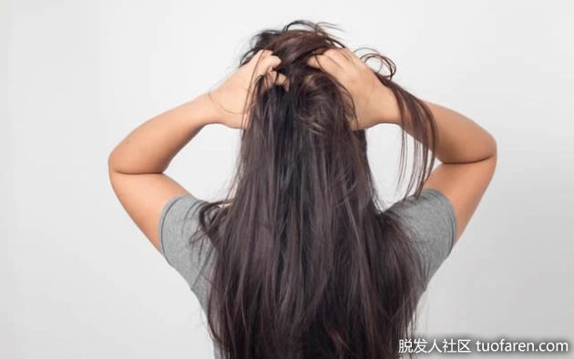 【圖】頭皮發癢與脱髮：兩者有何關係？