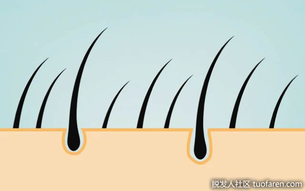 【圖】毛囊：完整的結構、功能及相關疾病