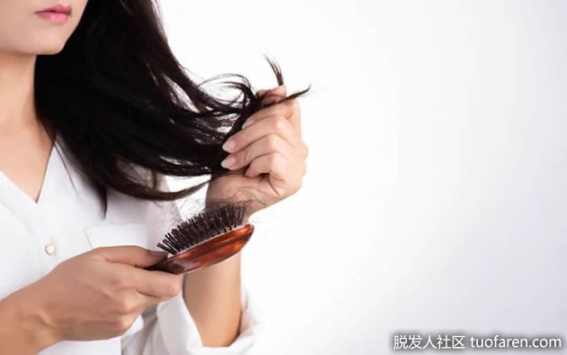 【圖】激素失衡會導致脱髮嗎？